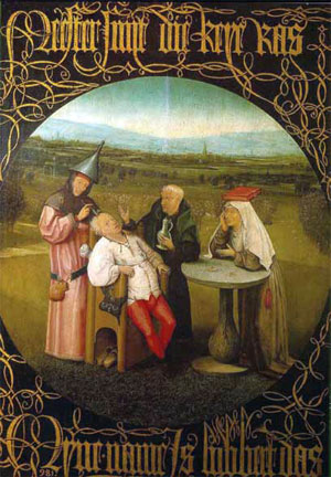 Ilustración de una trepanación.